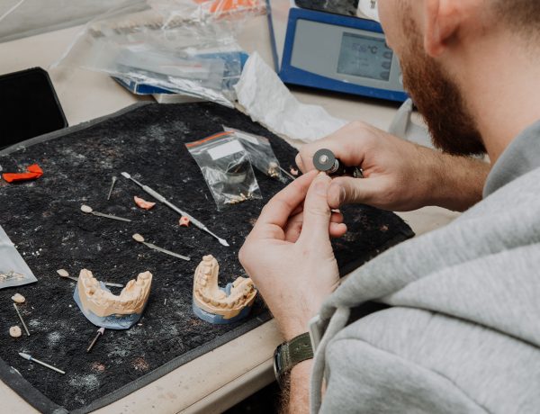 dental implants