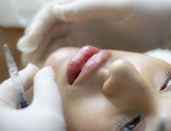 Things you Should Know About a Facelift