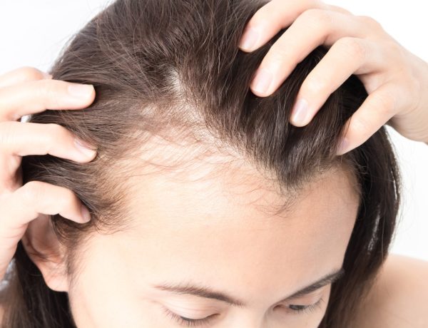 Hair Replacement vs Transplant