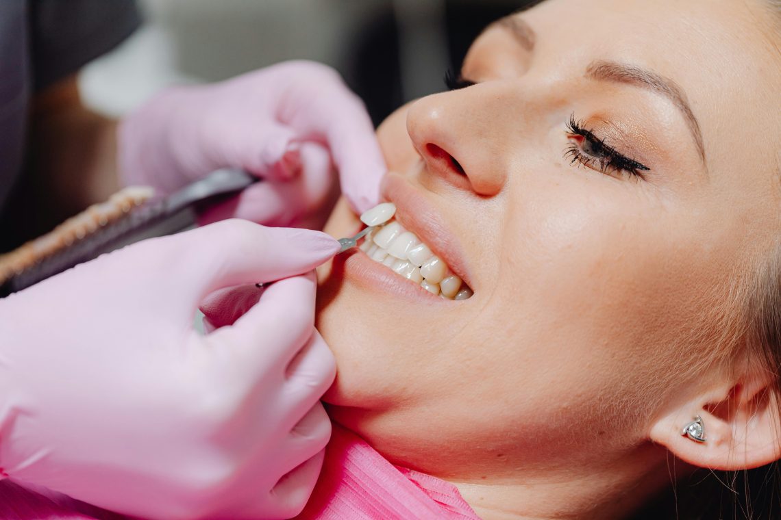 Porcelain Veneers