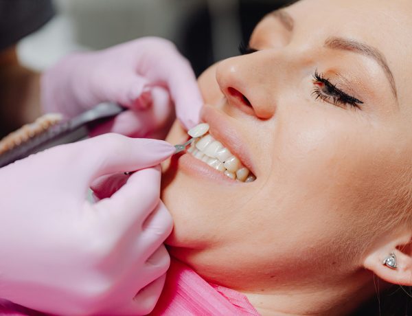 Porcelain Veneers