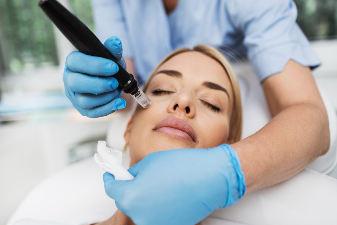 PRF Microneedling