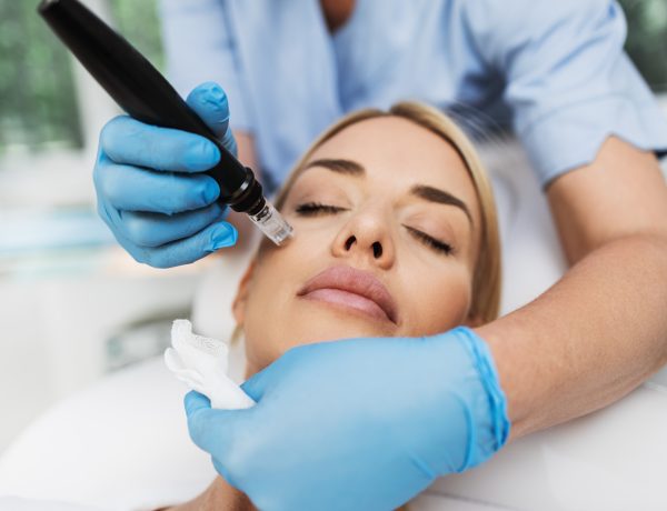 PRF Microneedling