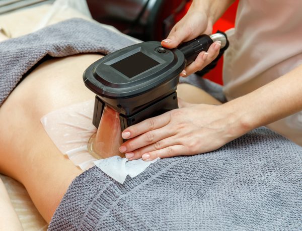 CoolSculpting Sessions in Brampton
