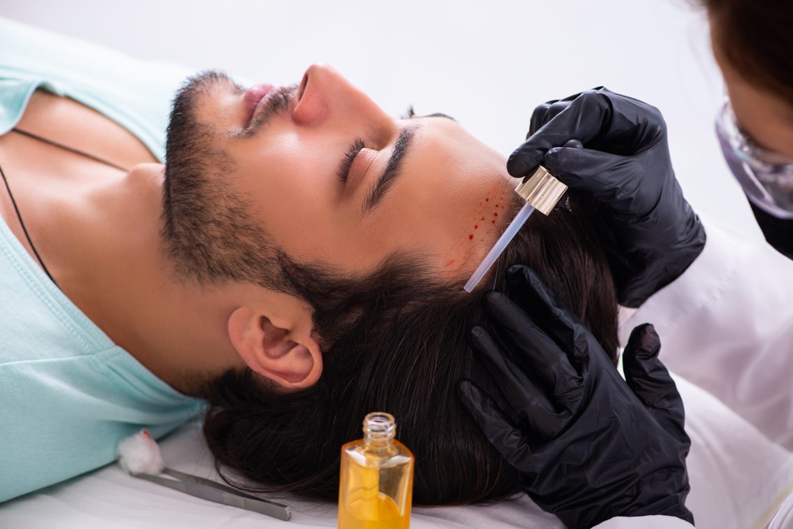 hair replacement for men