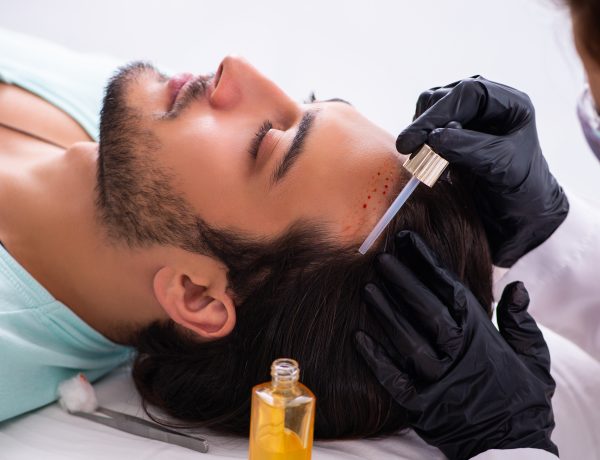 hair replacement for men