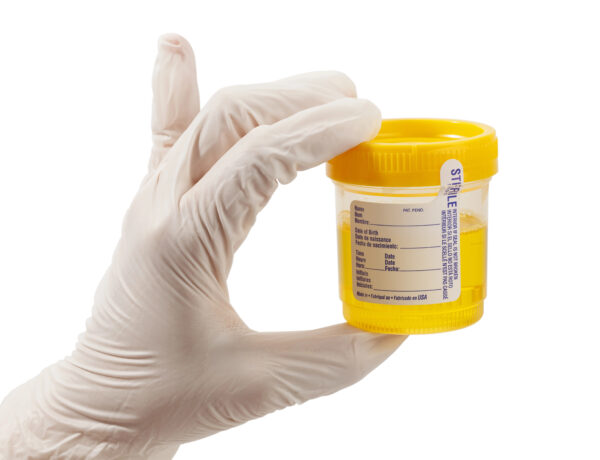 Lab-based urine tests