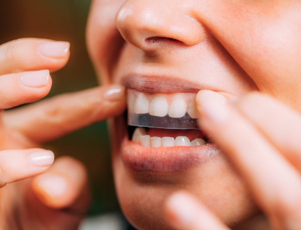 whitening strips