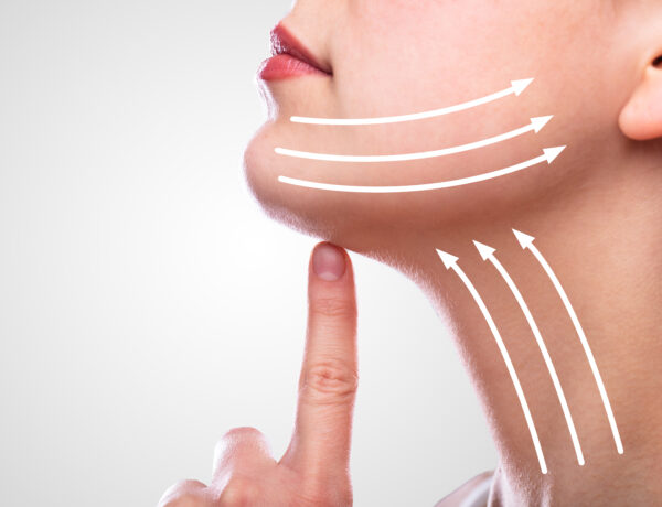 Neck Lift