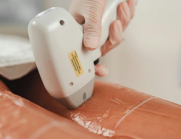 laser hair removal