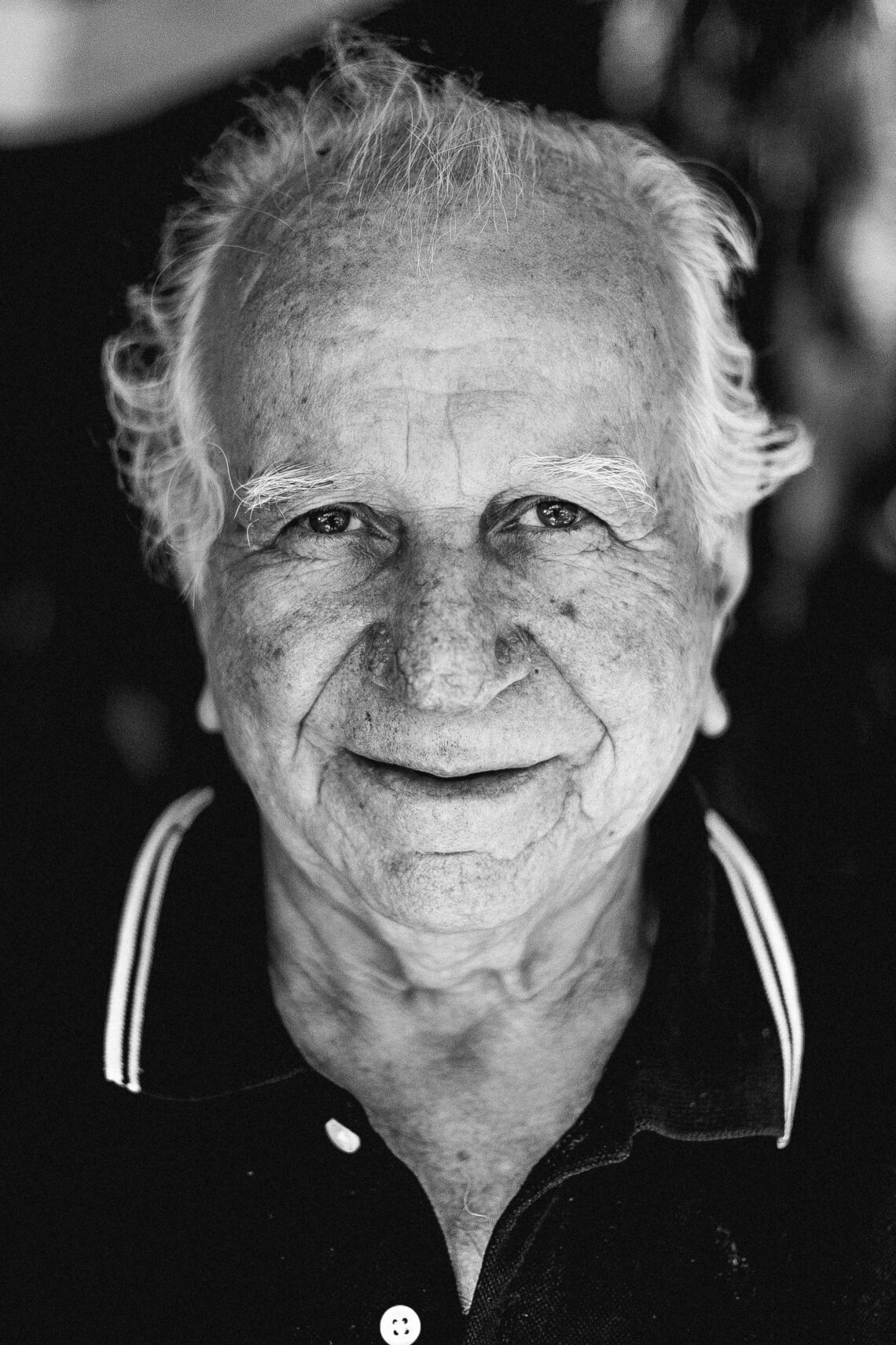 facial aging