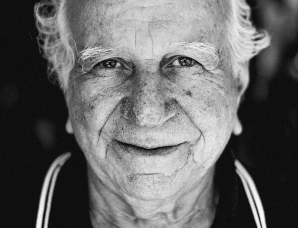facial aging