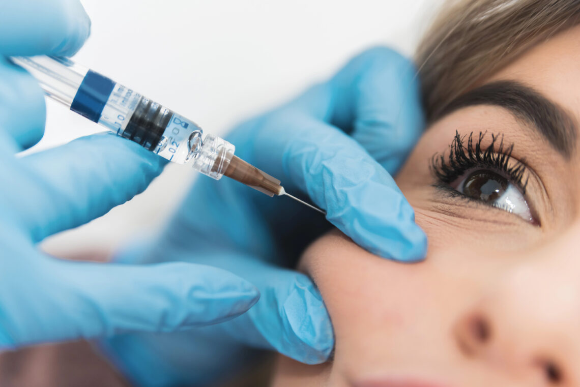 Sculptra Filler