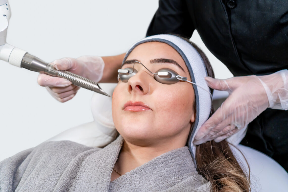IPL Photofacial Treatments