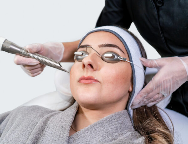 IPL Photofacial Treatments