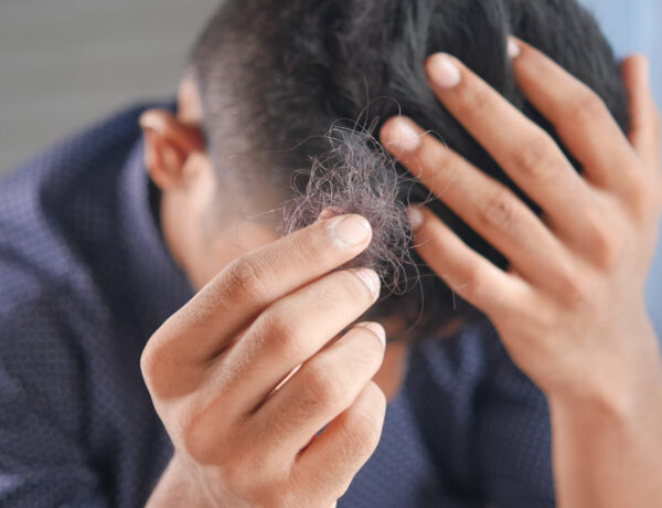 Preventing Hair Loss