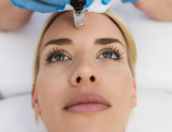 Microneedling