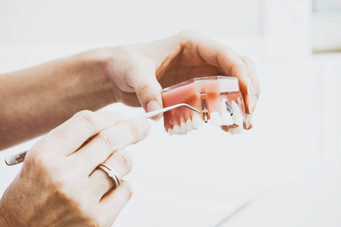 Zygomatic implants