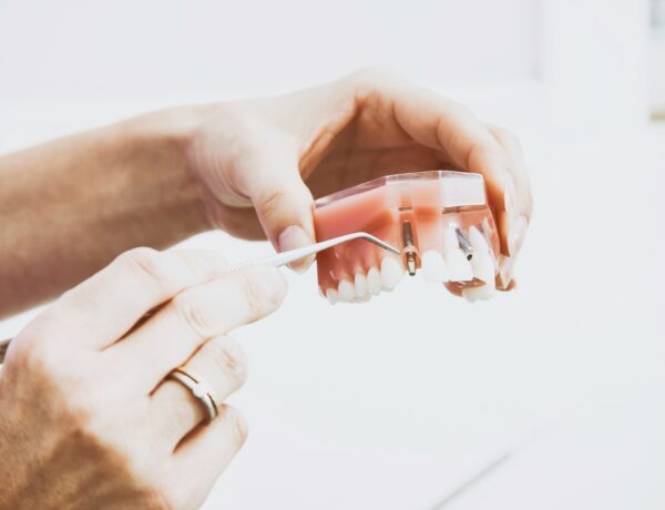 Zygomatic implants