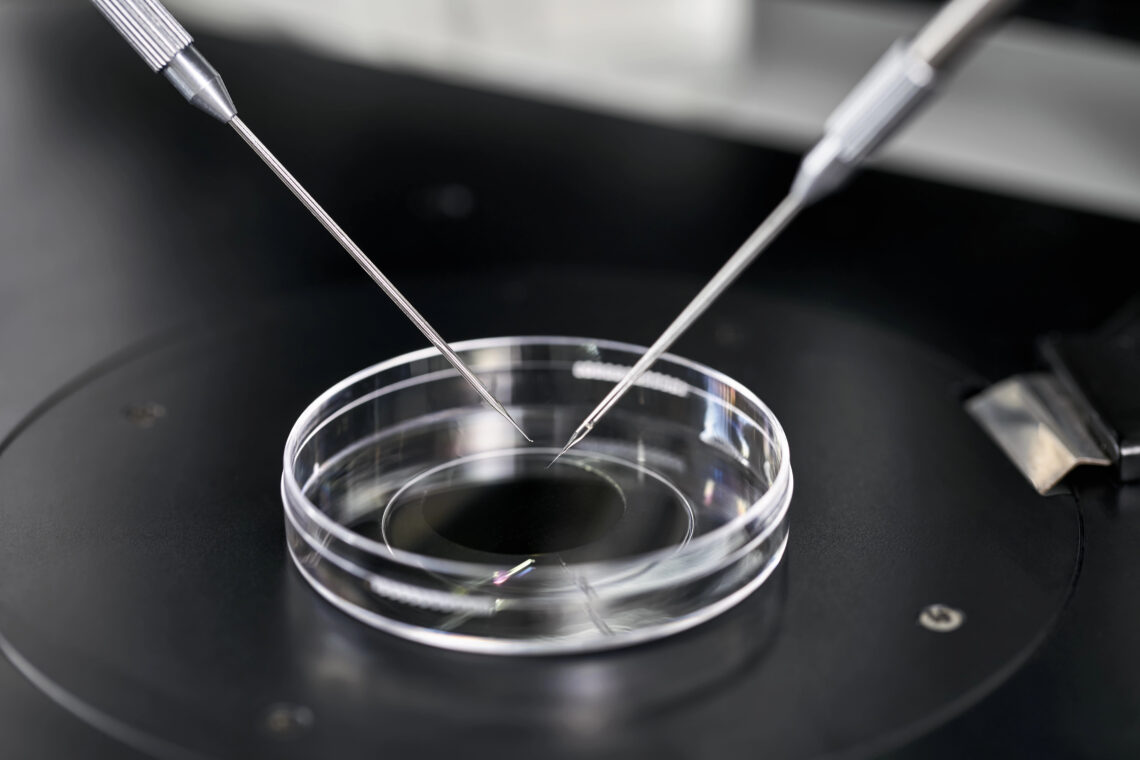 IVF Egg Quality