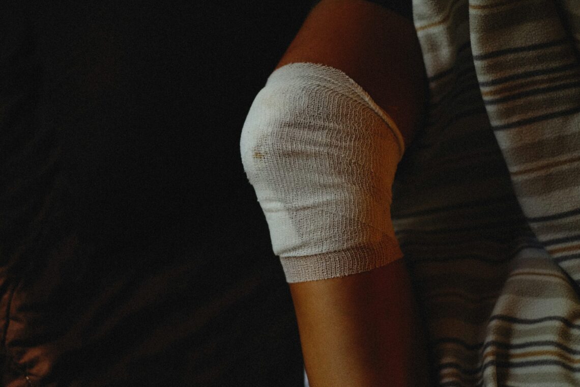 Severe Burn Injuries