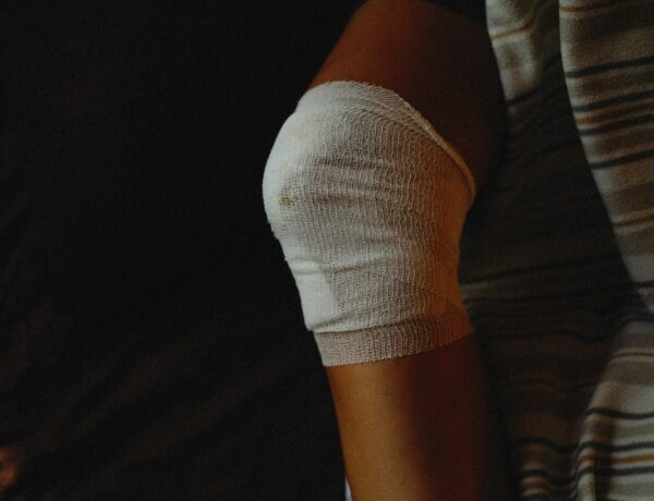 Severe Burn Injuries