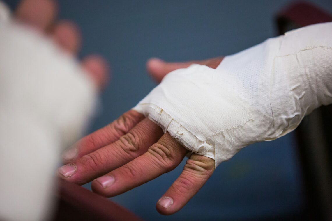 fractured hand