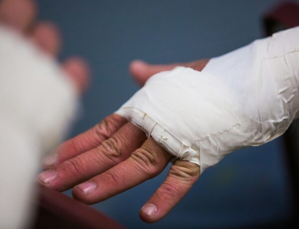 fractured hand