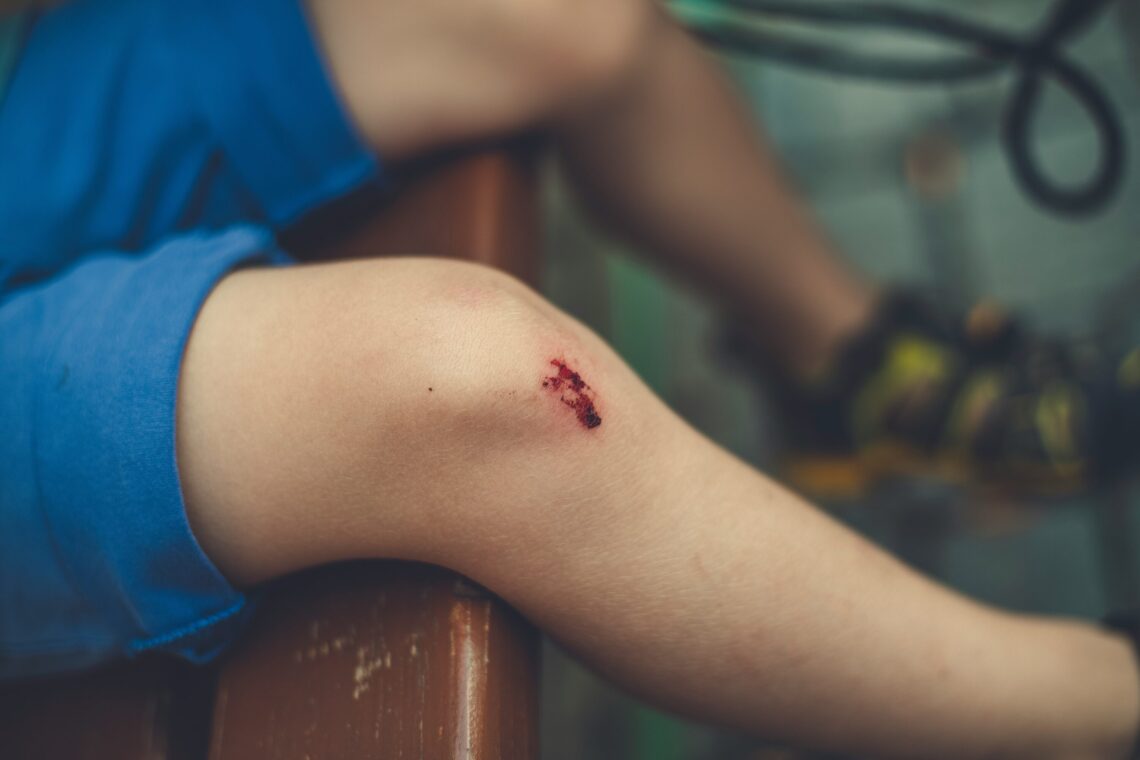Cuts and Scrapes