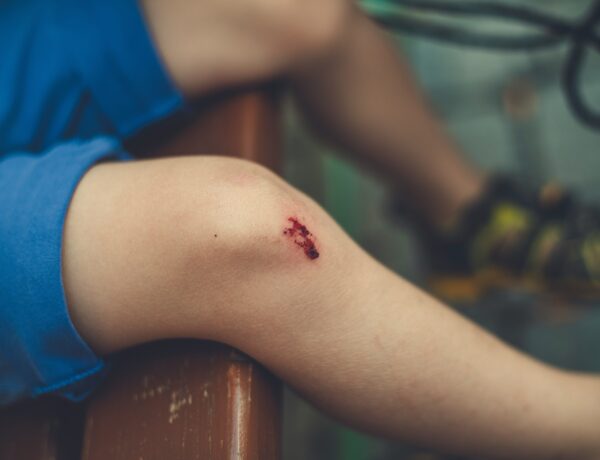 Cuts and Scrapes