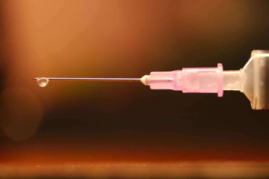 Botox treatment