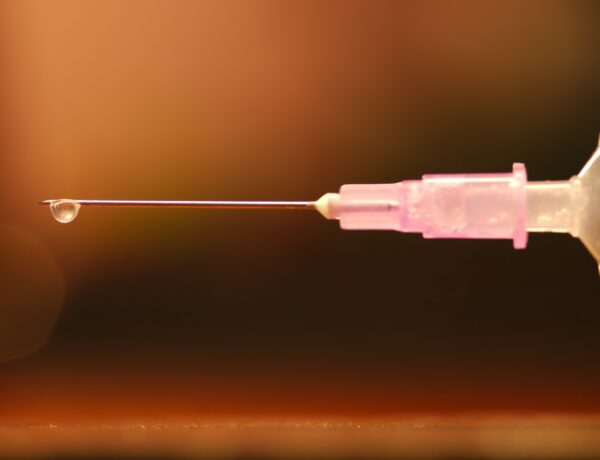 Botox treatment