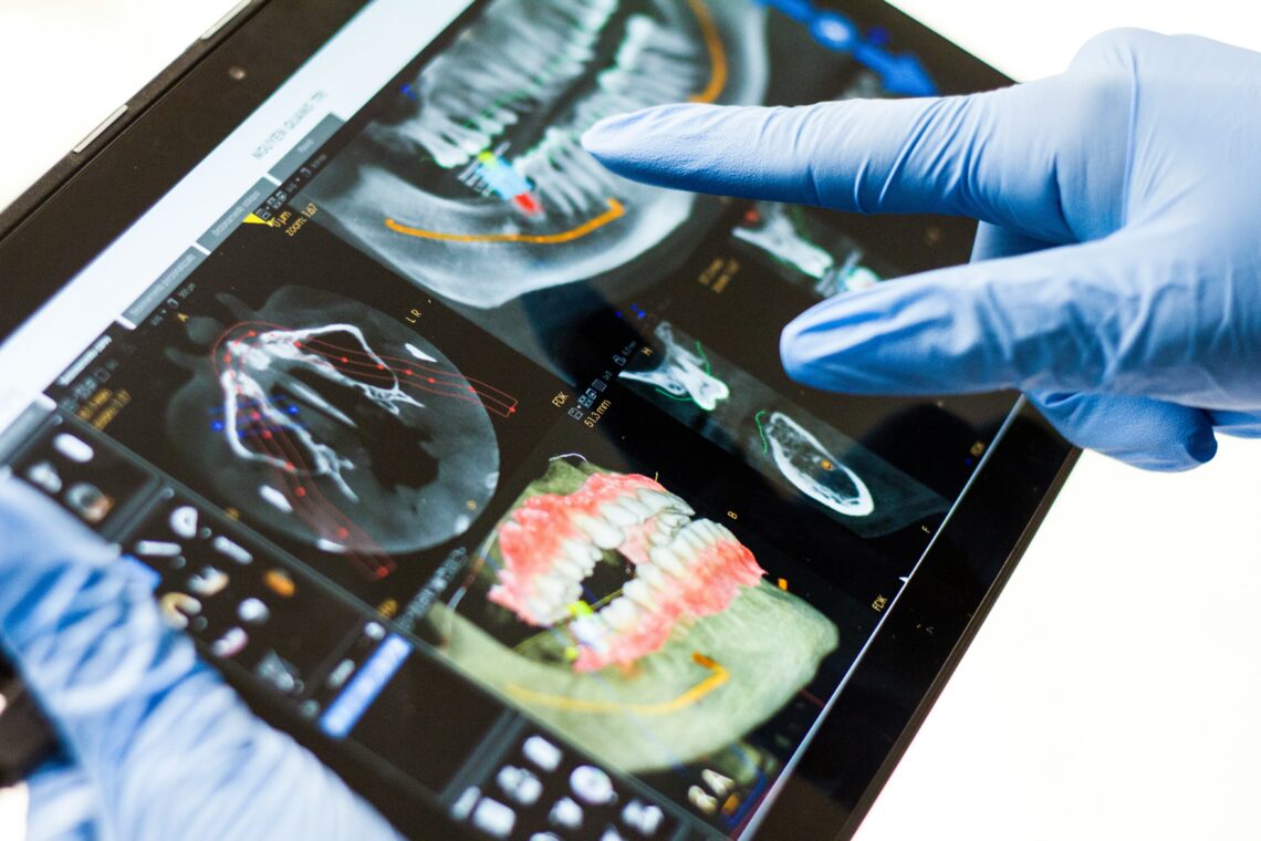 cosmetic dentistry trends