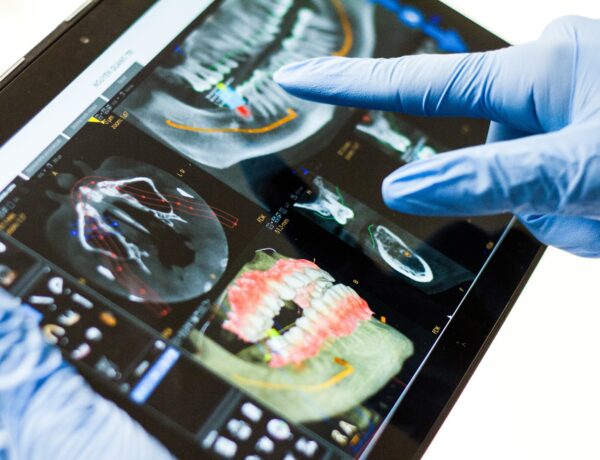 cosmetic dentistry trends