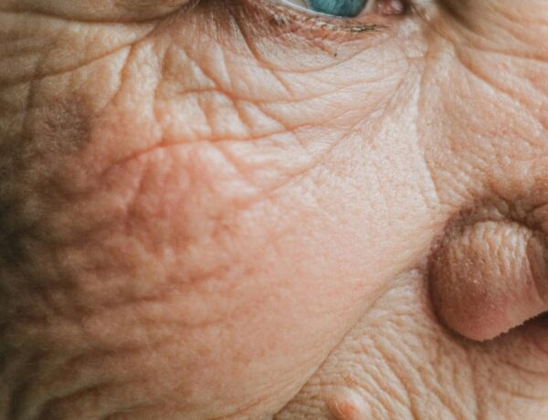 types of cataracts