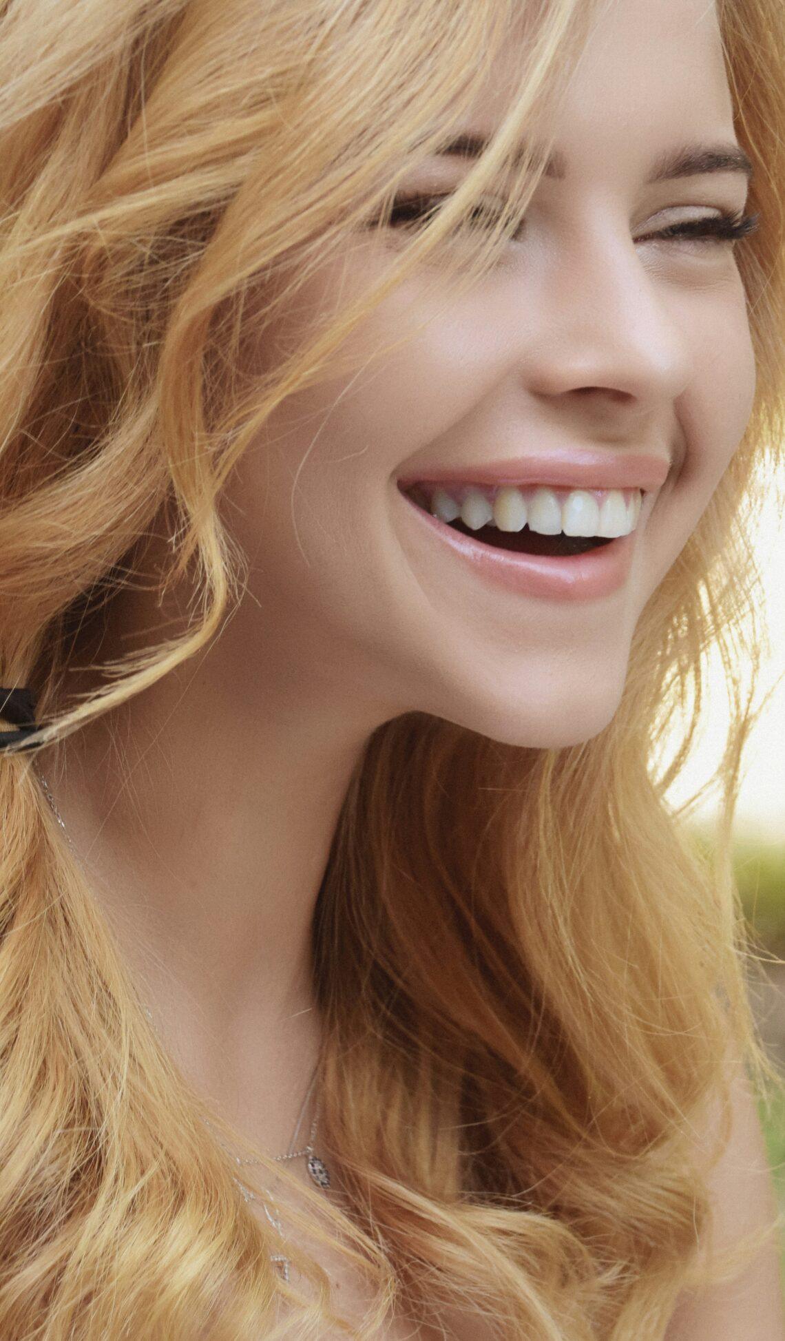 porcelain veneers