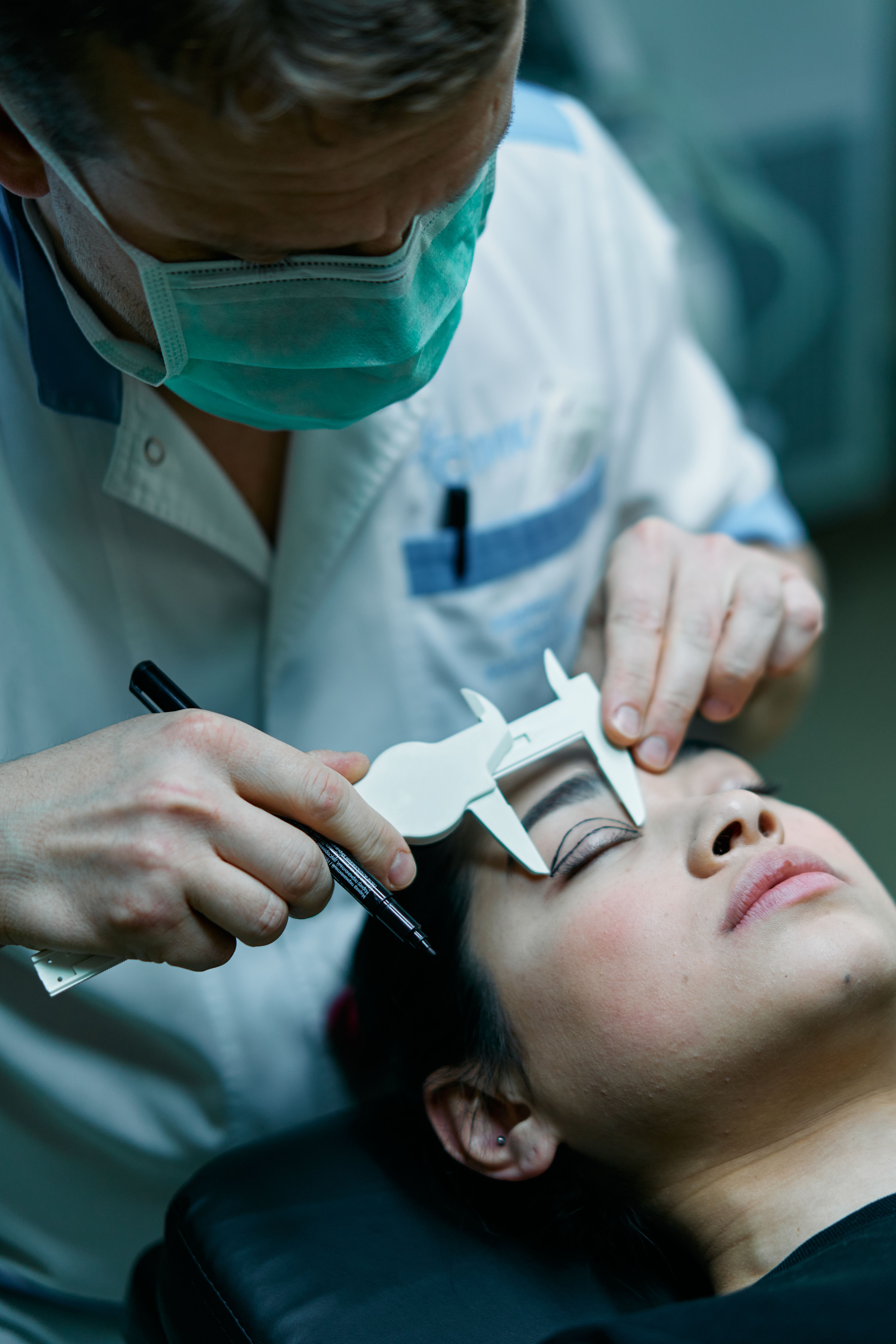Blepharoplasty