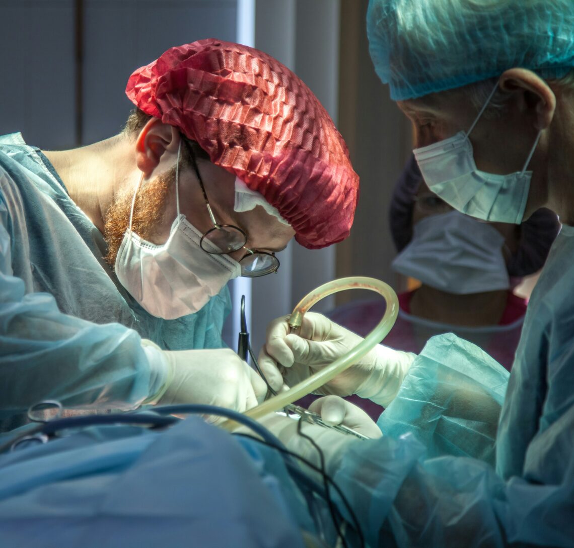 How to Prepare for Liposuction