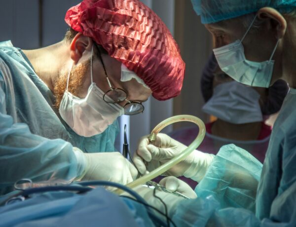 How to Prepare for Liposuction