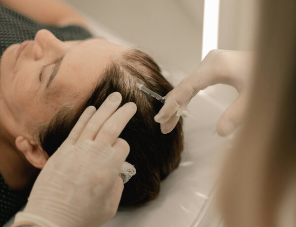 PRP injections for hair loss