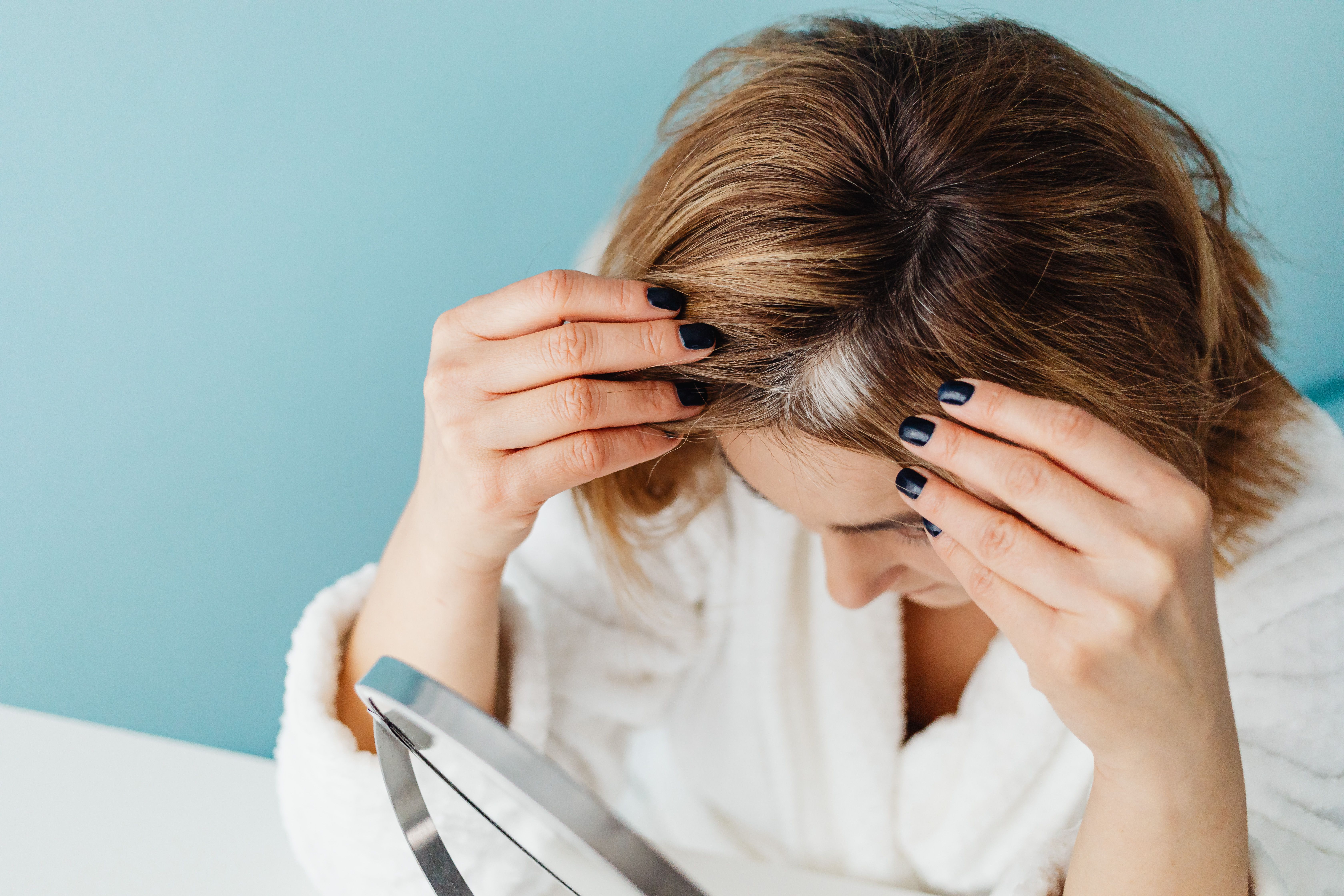 female hair loss causes