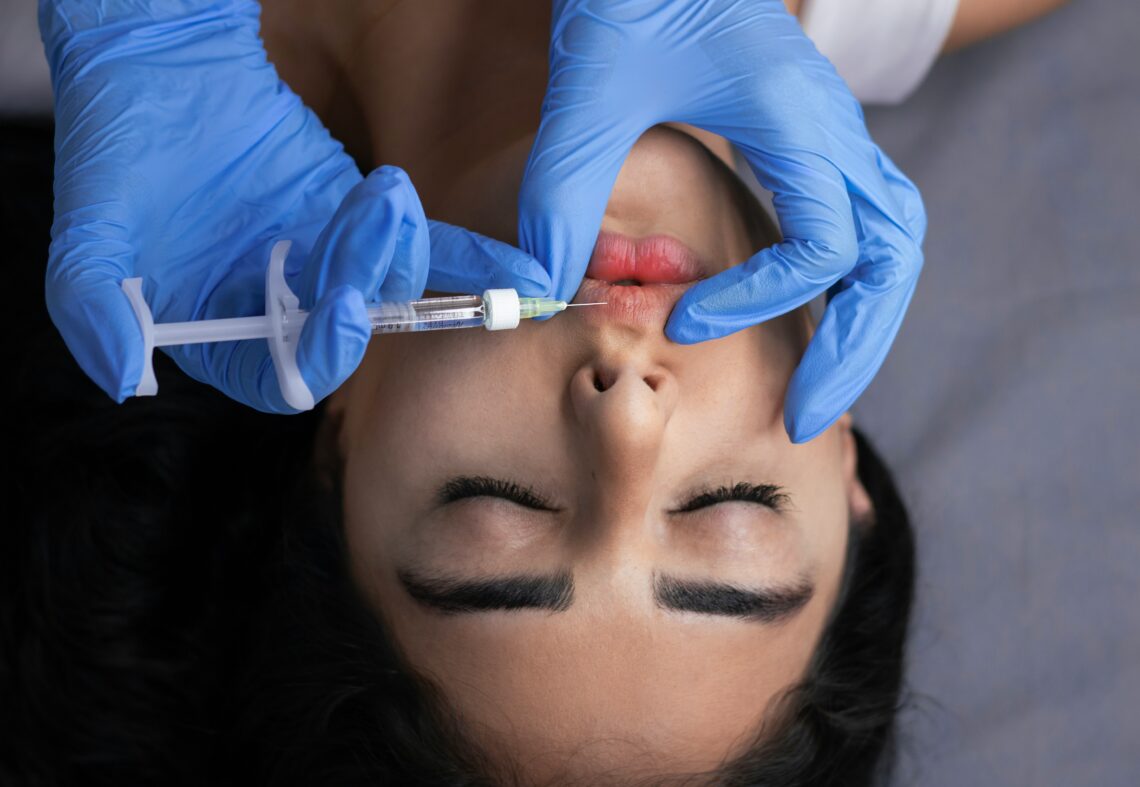 Restylane dermal filler