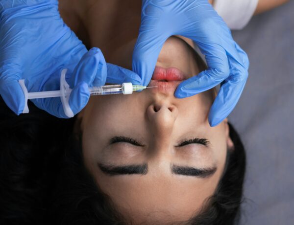 Restylane dermal filler