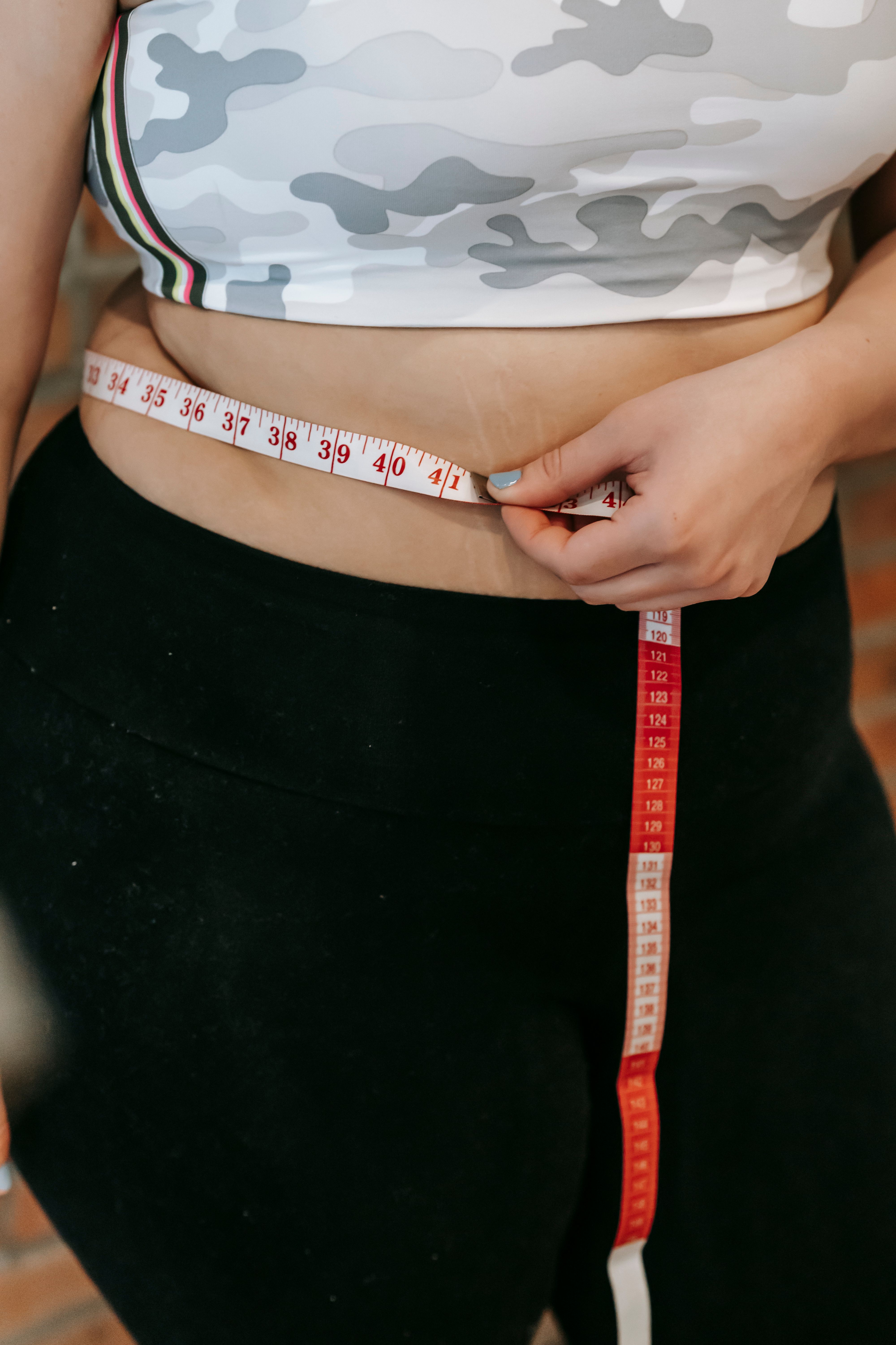 Liposuction Works Better Than Diet and Exercise