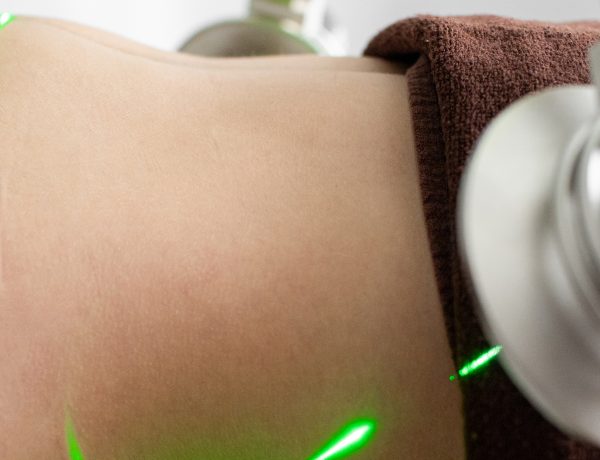 Laser-Assisted Lipolysis with EndoDefine: A Modern Approach to Fat Reduction