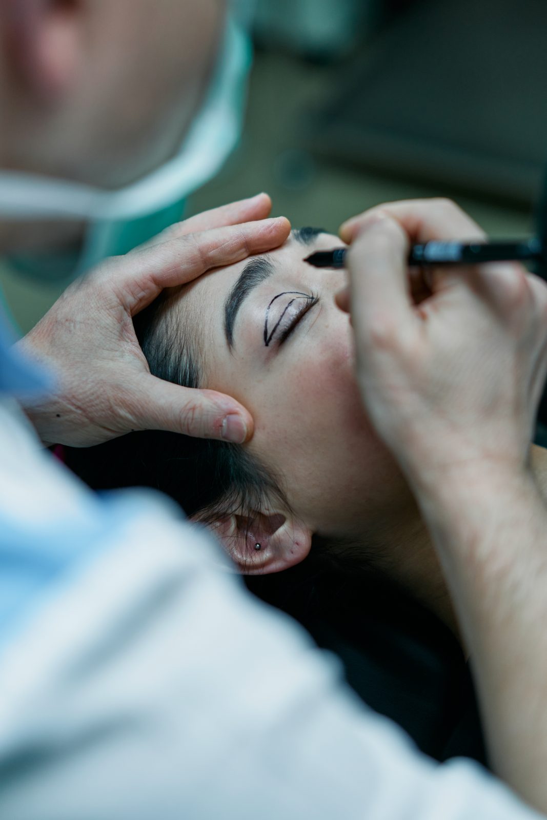 A surgeon marking a patient s eyelid