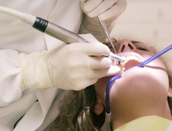 Dentist working working on woman s teeth