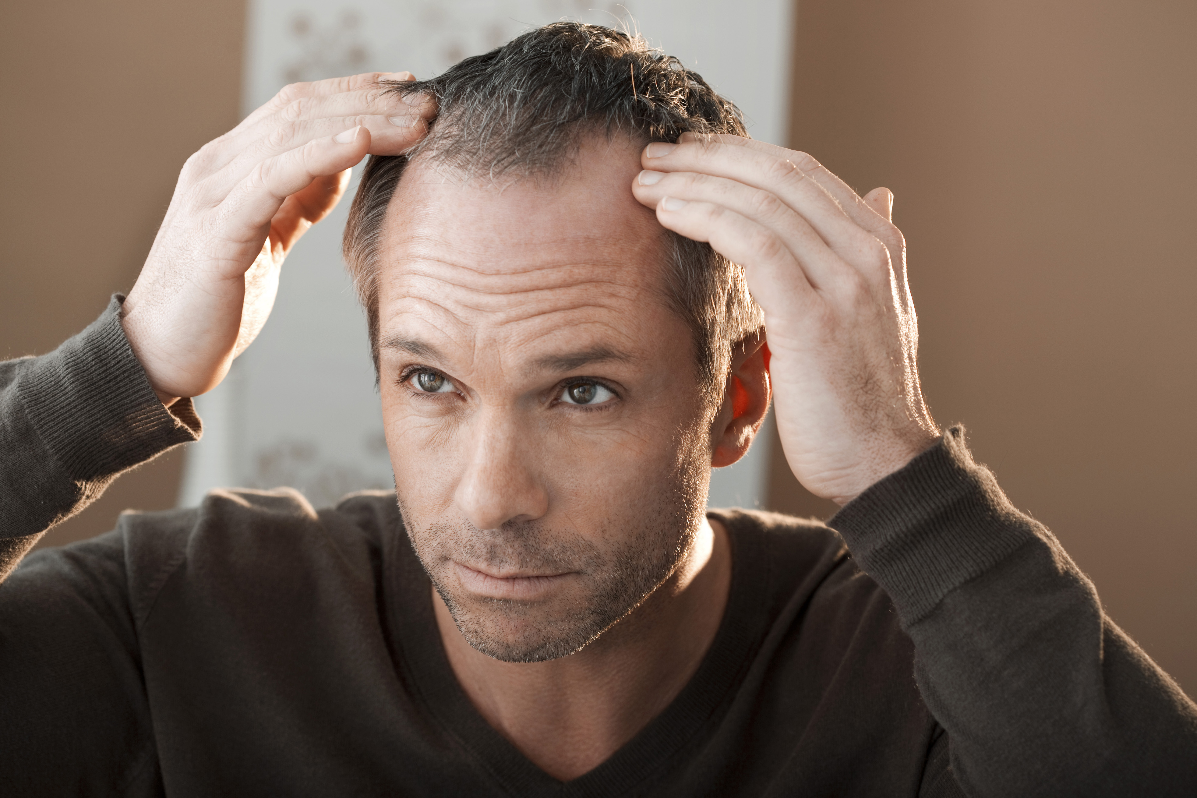 winter hair loss