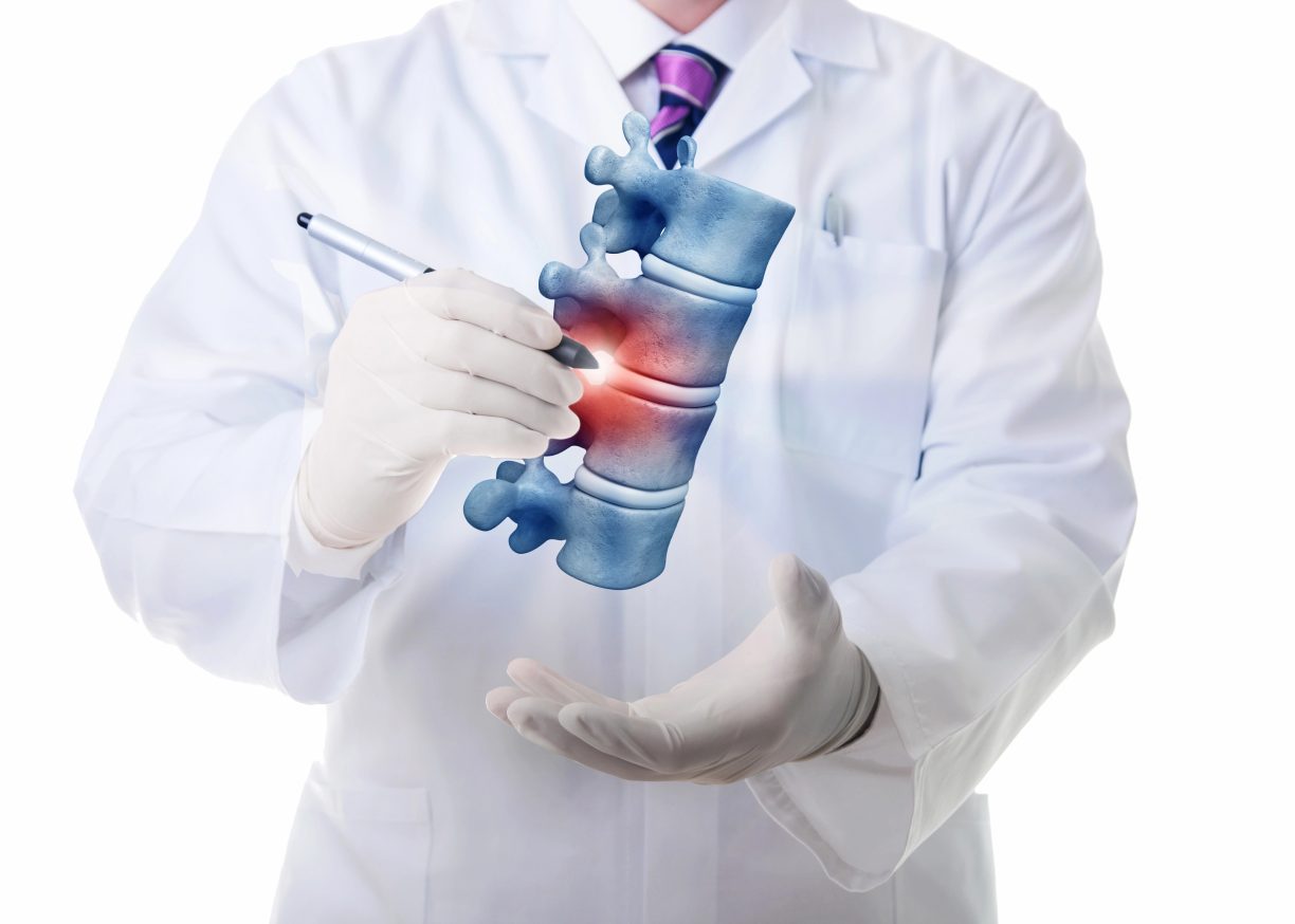 laser spine surgery