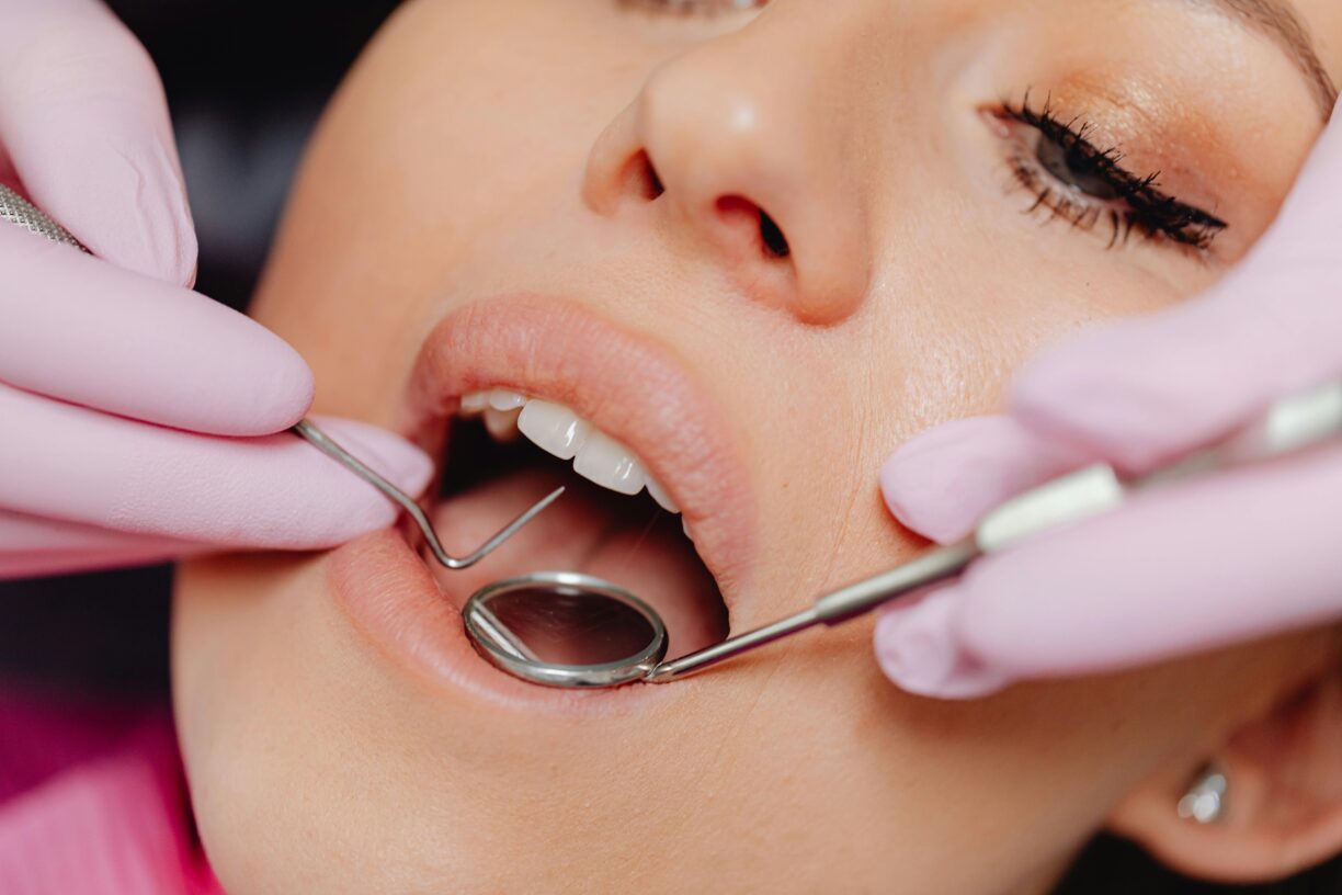 dental treatments in Turkey